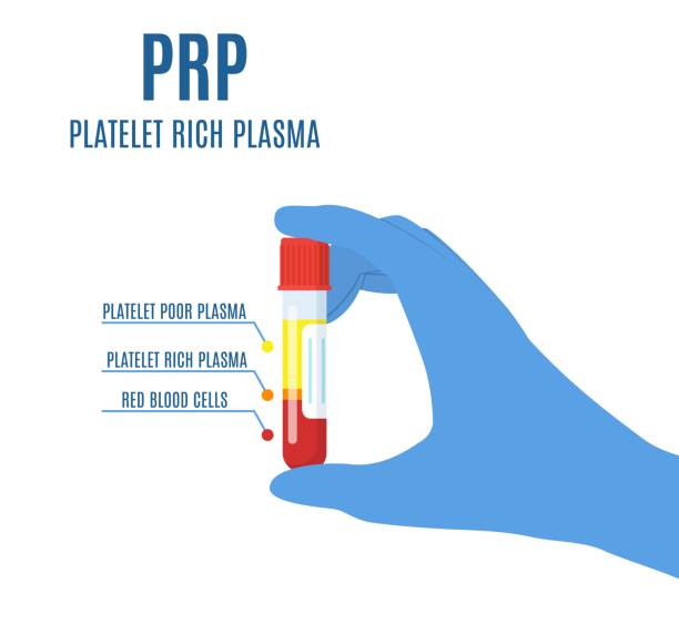 PRP composition after centrifuge